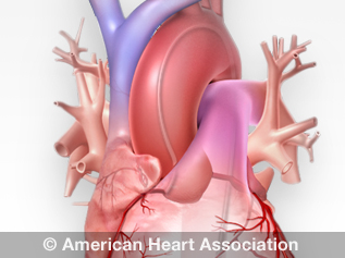 cardiac catheter