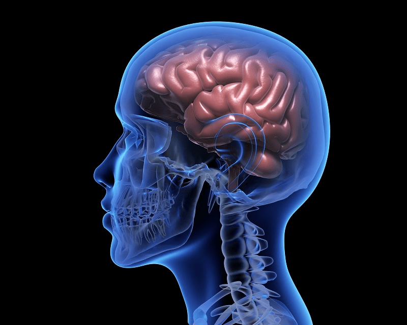 human brain after stroke