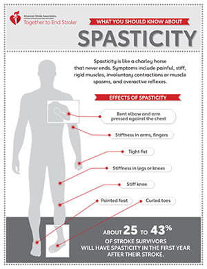 thumbnail image of the What You Should Know About Spasticity infographic