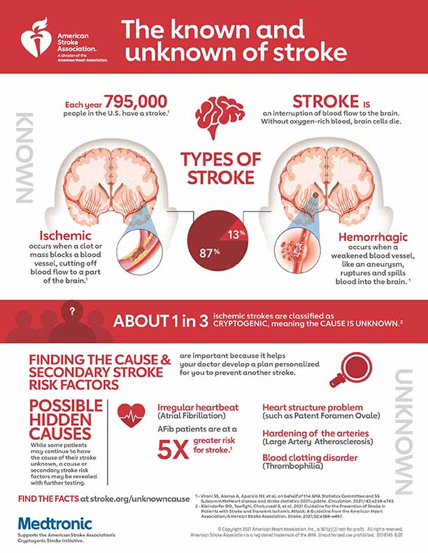 About Stroke