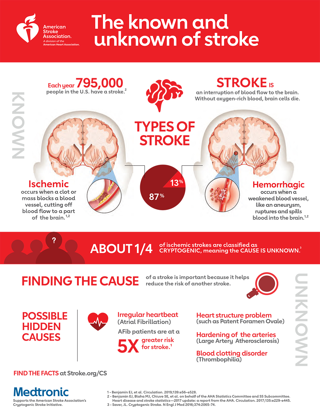 Ischemic Stroke Causes Signs Symptoms Ischemic Stroke - vrogue.co