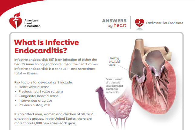 infective-endocarditis-american-stroke-association