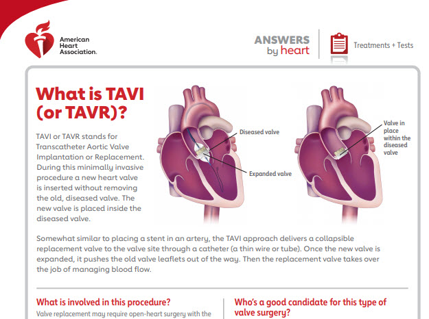 What is TAVR? (TAVI) American Stroke Association