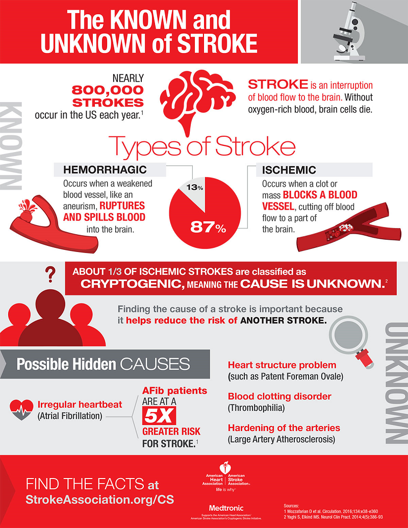 What Causes Cryptogenic Stroke ? (Infographic) | American Stroke ...