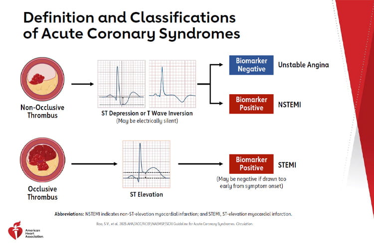 AHA Clinical Update: 2025 Guideline for the Management of Patients with Acute Coronary Syndromes