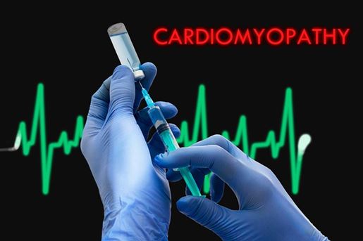 cardiomyopathy