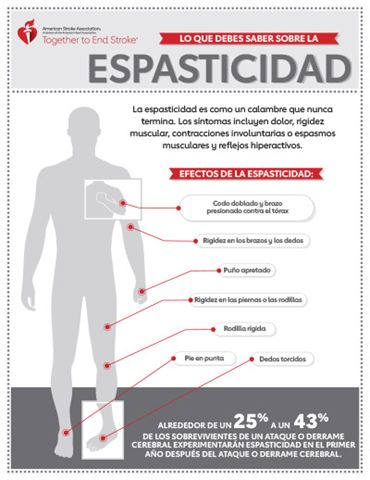 imagen en miniatura de la infografía Lo que necesitas saber sobre la espasticidad